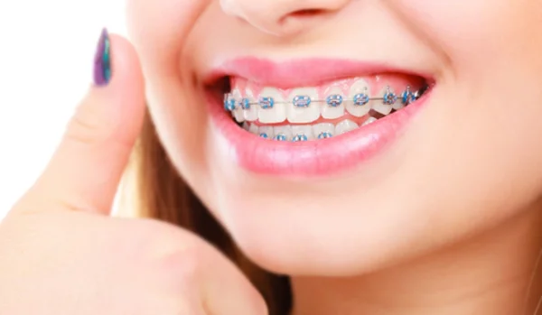 Teeth Straightening