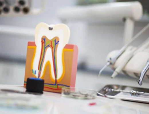 Root Canal Treatment