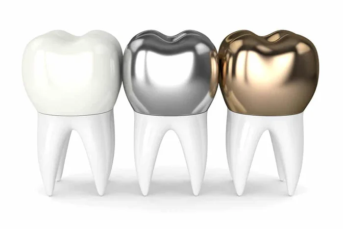 Dental Crown