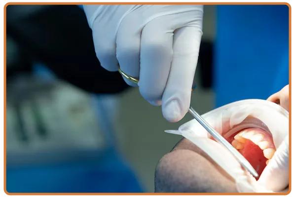 Gum Surgery