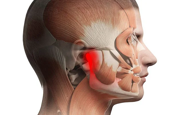 TMJ and Jaw Pain