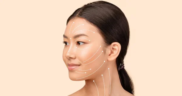 Thread Lift Treatment