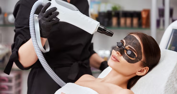 Carbon Laser Treatment