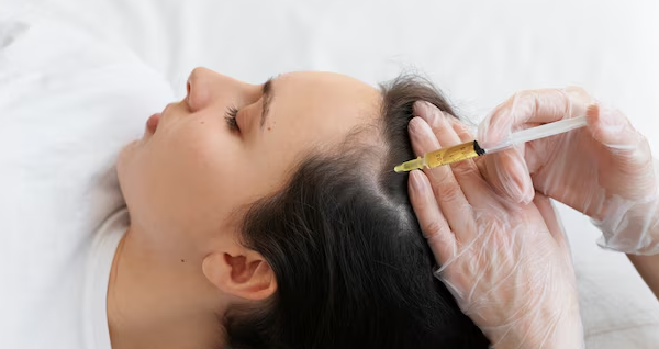 PRP Hair Treatment