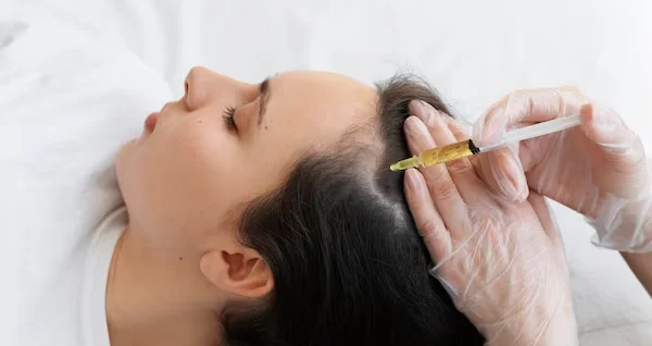 PRP Hair Treatment