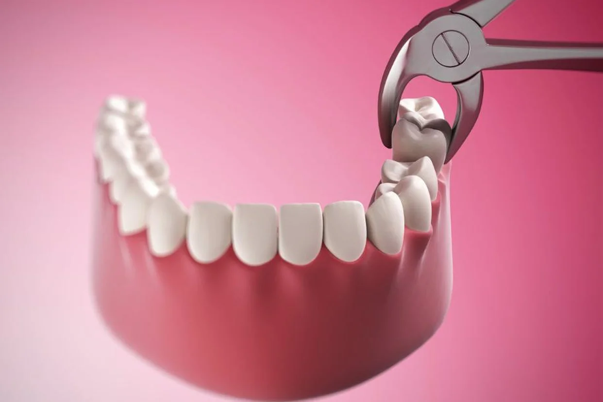 Surgical Dentistry