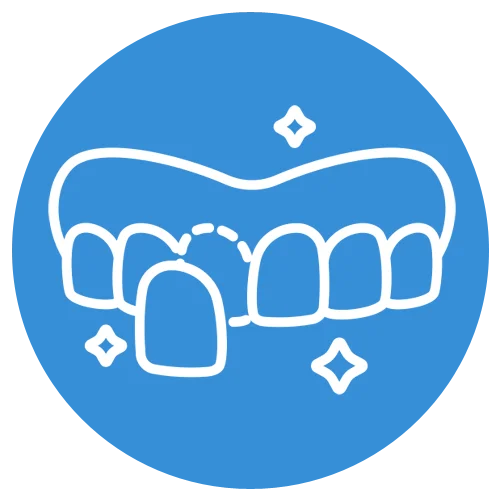 Dental Veneers